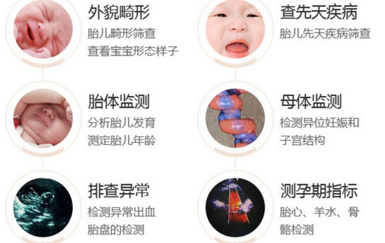 美国GE-E8S四维彩超优势: